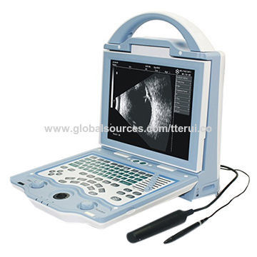 A hyper-parameter, Ophthalmology AB, OA830